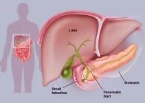Pancreatic Disease: Causes, Symptoms, and Treatment 2024